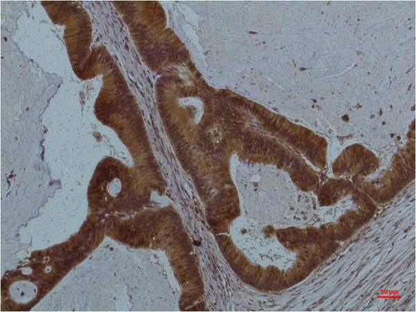 Anti-STAT3