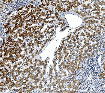Anti-GPNMB / Transmembrane glycoprotein NMB / HGFN