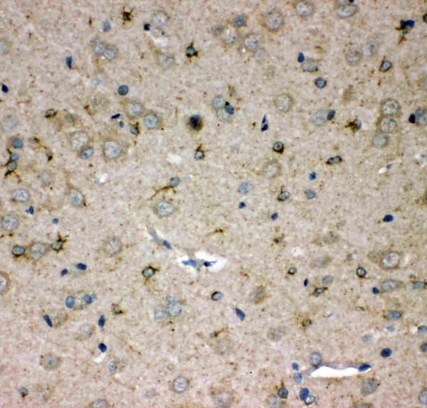 Anti-SPARCL1