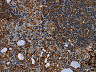 Anti-HMGCL