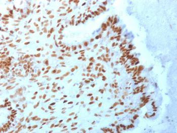 Anti-TLE1 (Synovial Sarcoma Marker) Monoclonal Antibody (Clone: TLE1/2062)