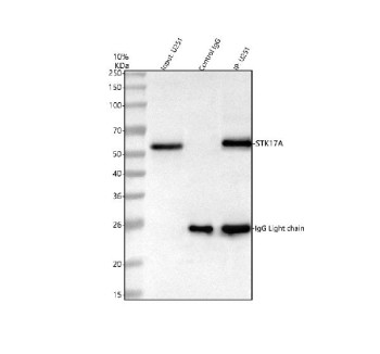 Anti-STK17A / Serine/threonine-protein kinase 17A