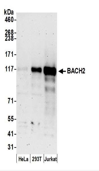 Anti-BACH2