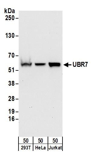 Anti-UBR7