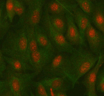 Anti-MAZ / Myc associated zinc finger protein
