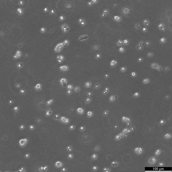 SK-MEL-2 Cells
