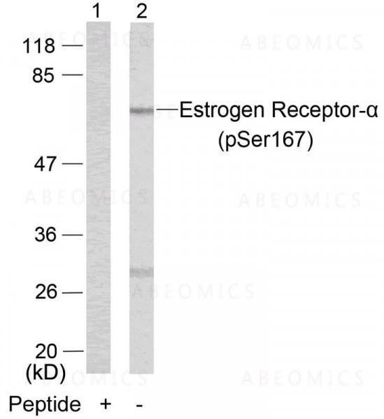 Anti-phospho-Estrogen Receptor- Alpha (Ser167)
