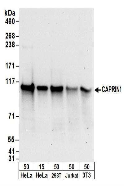Anti-CAPRIN1