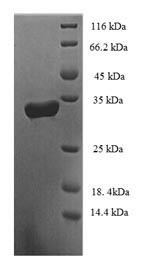 Probable D-tyrosyl-tRNA (Tyr) deacylase 2 (DTD2), human, recombinant