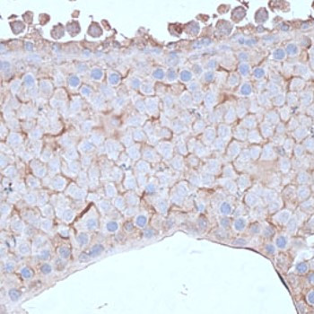 Anti-CIP2A / KIAA1524
