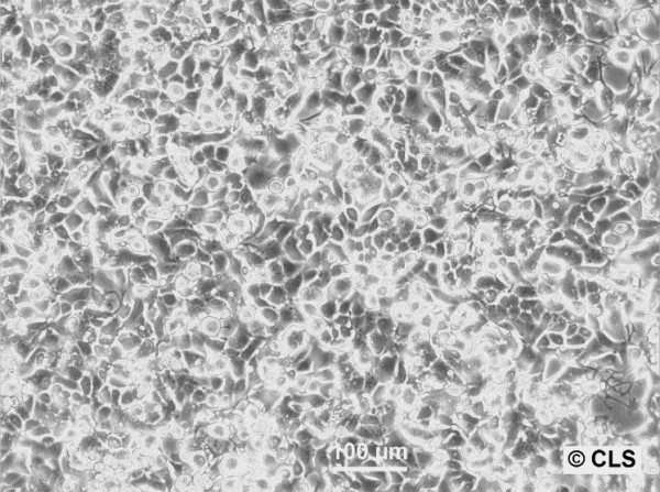 Zajdela-Hepatoma Cells