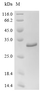 Large cysteine-rich periplasmic protein OmcB (omcB), partial, Chlamydia pneumoniae, recombinant