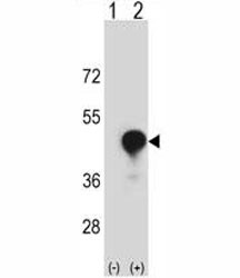 Anti-CD1c