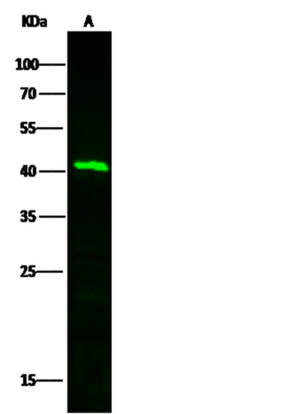 Anti-TFPI/LACI/EPI Monoclonal Recombinant Antibody