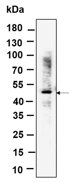 Anti-Recombinant RGS6, clone 5B6