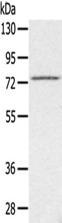 Anti-SLC26A5