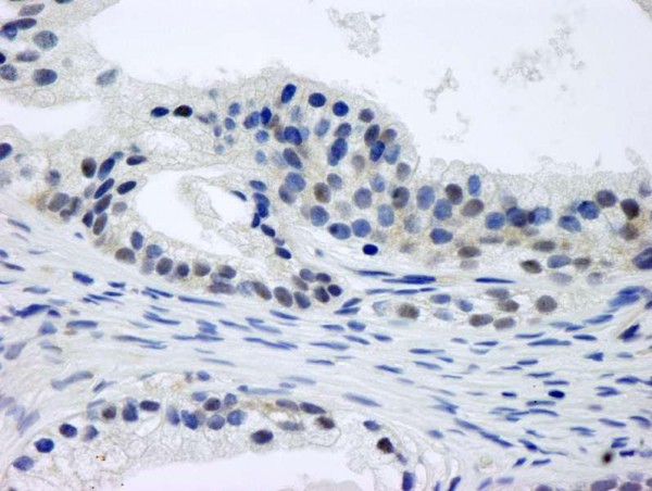 Anti-CSN1 (IHC)