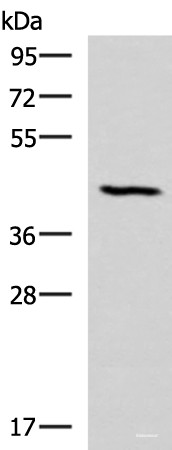 Anti-SMPD2