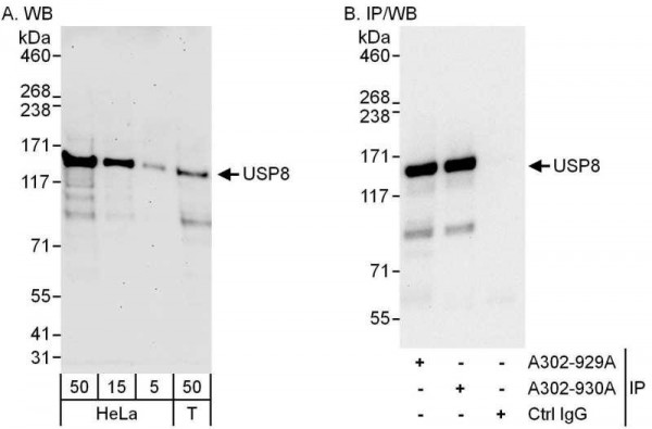 Anti-USP8