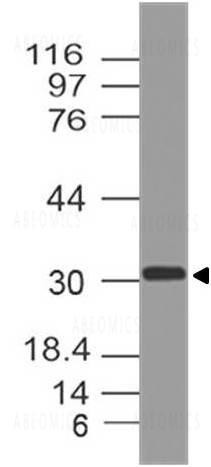 Anti-Myogenin (Clone: ABM30A5)