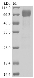Interleukin-4 receptor subunit alpha (IL4R), partial, human, recombinant