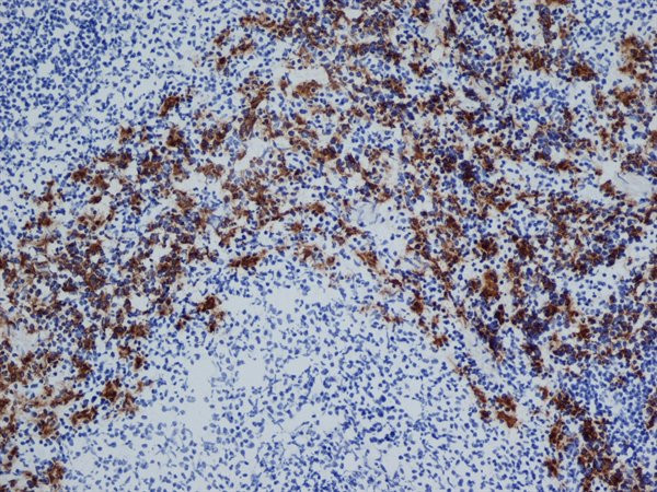 Anti-CD163, clone ED2