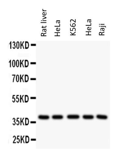 Anti-OLR1 / LOX1