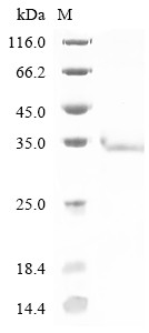 Reticulon-3 (Rtn3), partial, mouse, recombinant