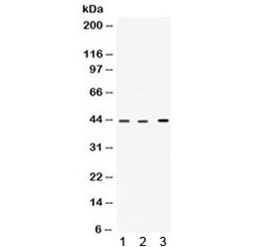 Anti-VEGFD / VEGF4