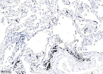 Anti-Claudin18.2 Monoclonal Antibody