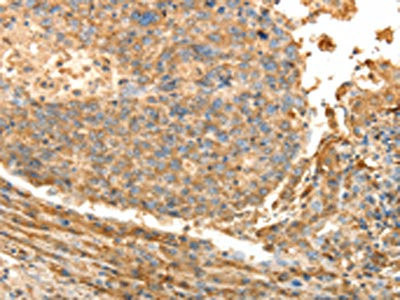 Anti-PSMD9