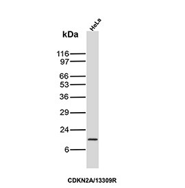 Anti-p16INK4a / CDKN2A, clone CDKN2A/13309R