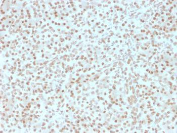 Anti-AKT1 (Prognostic Marker for Neuroendocrine Tumors) Monoclonal Antibody (Clone: AKT1/2491)
