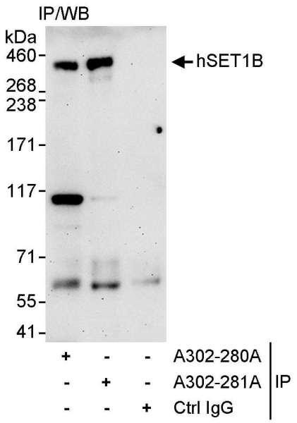 Anti-hSET1B