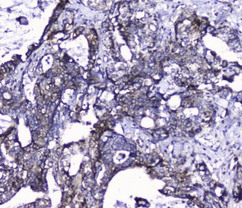 Anti-Cdk6