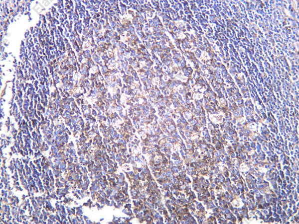 Anti-Recombinant IgG, clone C112461