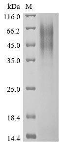 Spike glycoprotein (S), partial, human betacoronavirus 2c EMC/2012, recombinant