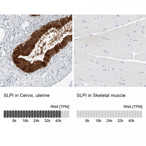 Anti-SLPI