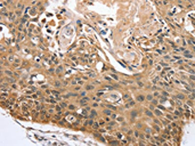 Anti-RBM38