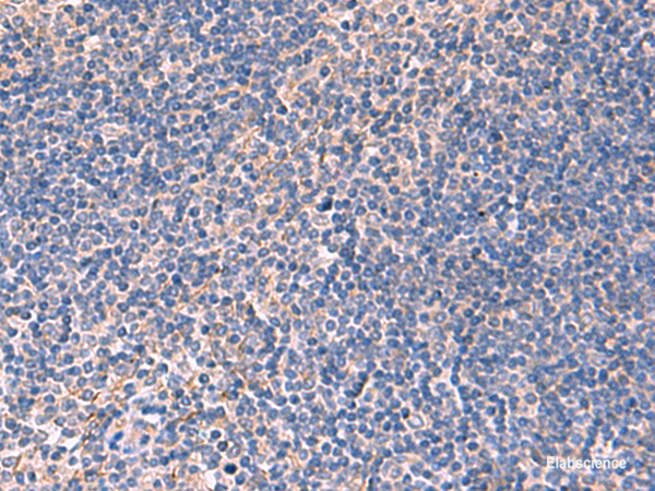 Anti-INPP5B