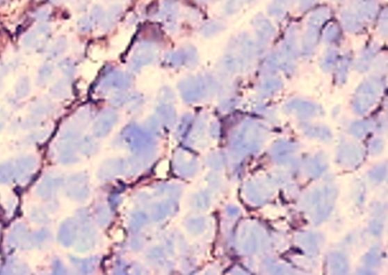 Anti-MUC16, clone X75