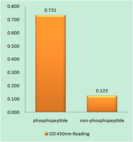 Anti-phospho-PKC beta (Ser661)