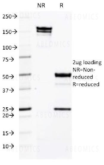Anti-CD50 / ICAM3 Monoclonal Antibody (Clone: CG106)