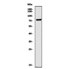 Anti-GnRH Receptor / LHCG Receptor