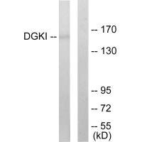Anti-DGKI