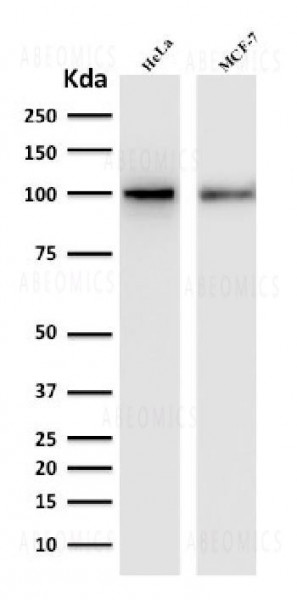 Anti-ENAH / MENA (Actin Regulator) Monoclonal Antibody (Clone: ENAH/1988)