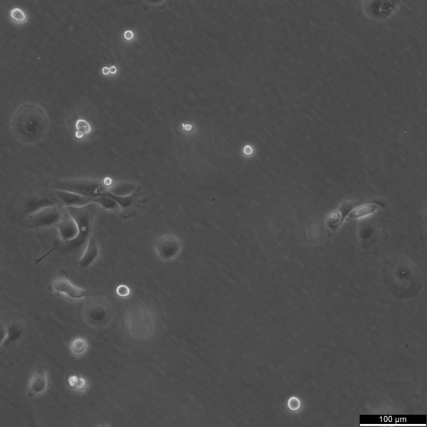 MKN-7 Cells