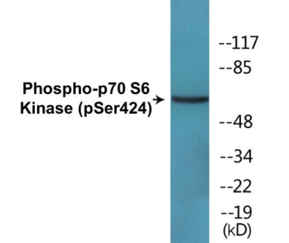 p70 S6 Kinase (Phospho-Ser424) Colorimetric Cell-Based ELISA Kit