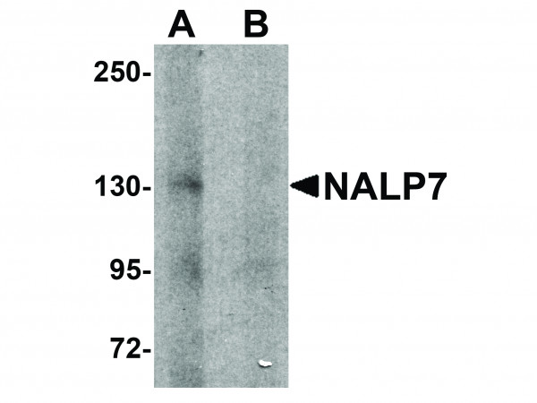 Anti-NALP7