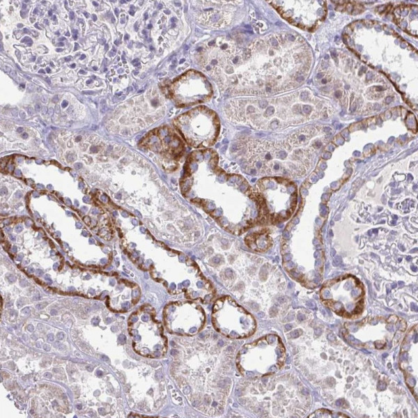 Anti-RNASEH1